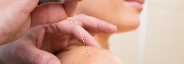 Dry-Needling-in-Chillicothe-OH Dry Needling in Chillicothe OH